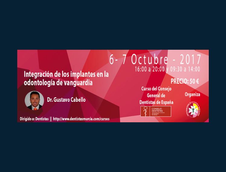 Integración de los implantes en la odontología de vanguardia
