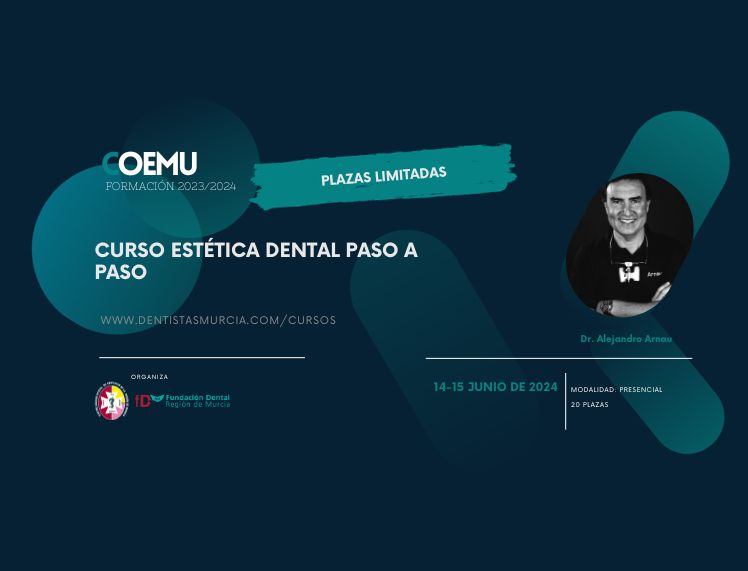 Curso de estética dental paso a paso