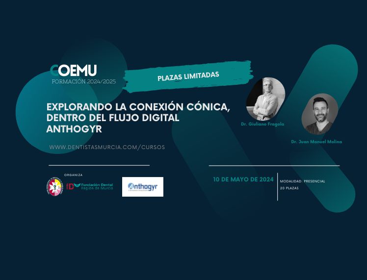 Explorando la conexión cónica, dentro del flujo digital Anthogyr